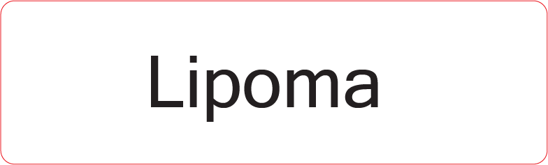 Lipoma - 40 x 12, PAPER, Black print on White Label, 800 per roll