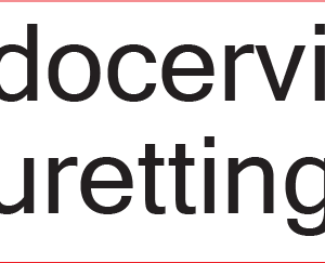 Endocervical Curettings -  40 x 12, PAPER, Black print on White Label, 800 per roll