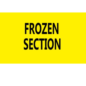 FROZEN SECTION - 70 x 40 Black on Fluoro Yellow 500 per roll