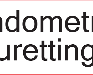 Endometrial Curettings -  40 x 12, PAPER, Black print on White Label, 800 per roll
