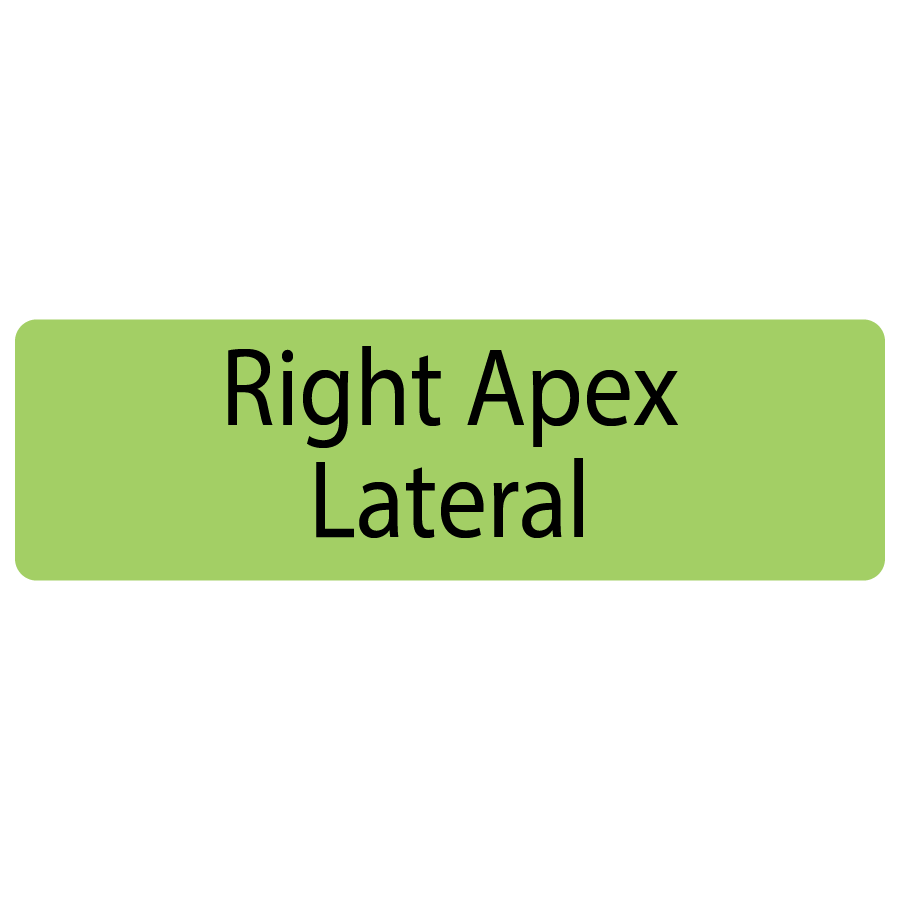 Right Apex Lateral, 40 x 12, PAPER, Black print on Green Label, 800 per roll