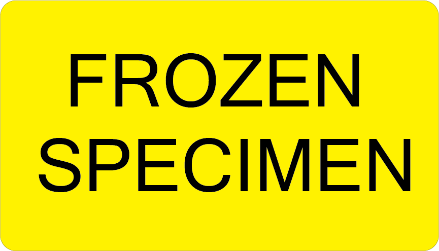 FROZEN SPECIMEN - 70 x 40 Black on Fluoro Yellow 500 per roll